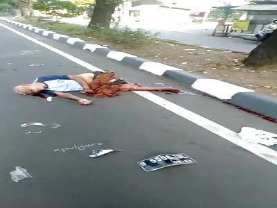 accident with fatal motorcyclist victim loses leg 