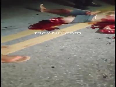 Danm man with shattered leg and hand after motorcycle accident