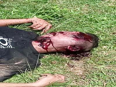 Man agonizing after Shots