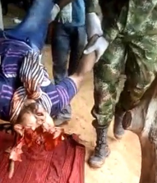 Old Guy`s Head Cracked Like a Watermelon