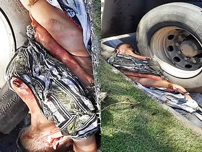 Danm. man totally wrecked after being crushed by truck 