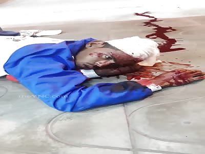 thief in agony after attempted robbery with a knife