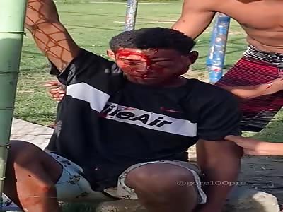 man with two shots to his face still alive 