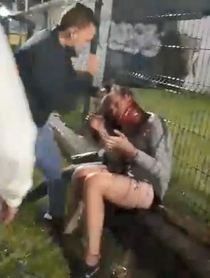 Transgender Girls Cruelly Beaten in Colombia