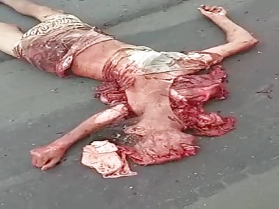 Body Crushed by Truck Becomes Unrecognizable Even to His Mother...