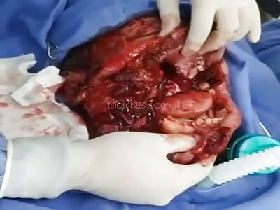 Fucking Hell! You'll Never Guess What Did This 