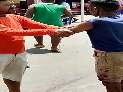 Damn. man loses arm in accident 