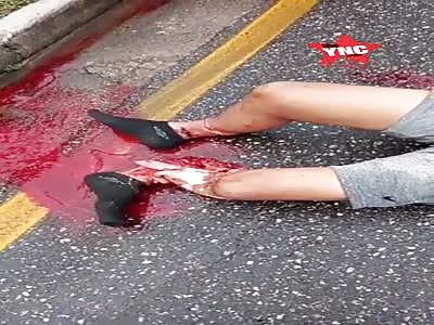 man in agony with shattered leg after accident 