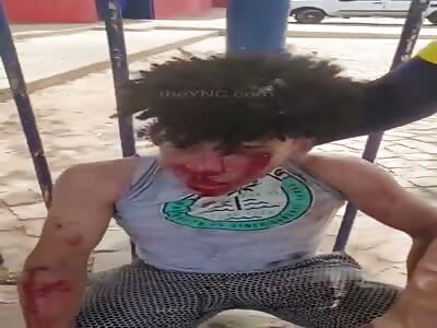 thief is brutally beaten 