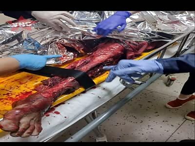 drug debts collect collection 