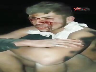 thief is brutally punished 