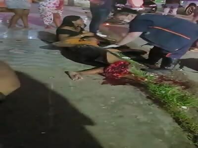 man in agony with his leg shattered after an accident 