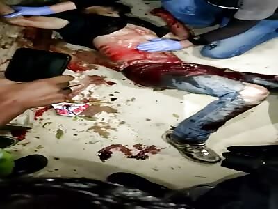 thief in agony after being beaten and stabbed 