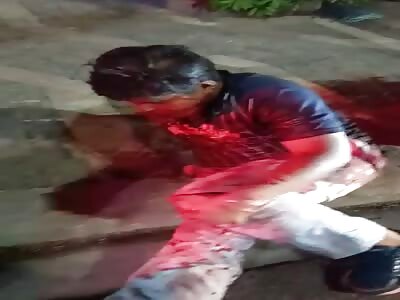 motorcyclist in agony after accident 