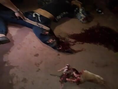 brutal accident where man loses his leg