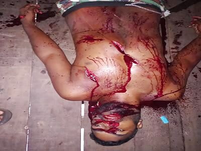 Last breaths of life after being attacked with a machete 