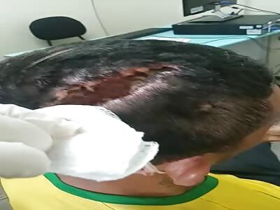 Son of a bitch, this young man has worms instead of brains 