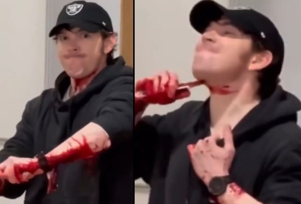 This Attention Seeker Is Crazy