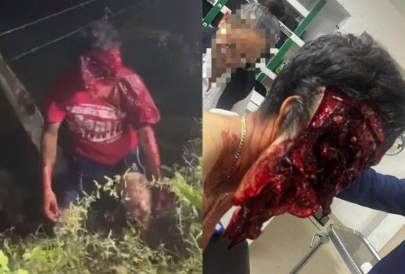 DAMN, Motorcyclist`s Face Slit In Halves 