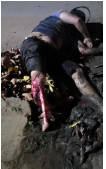 The victim had their leg torn off in a horrific accident.