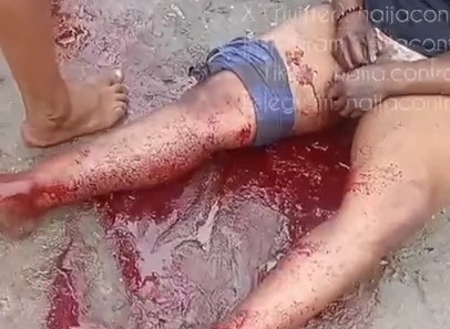 Gang member bleeding to death after getting shoot by rival 