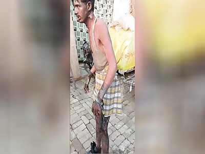 MAN IN SHOCK AFTER BEING TIED TO A TREE AND BURNED