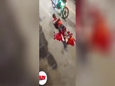 AGONY AFTER SERIOUS INJURY IN ACCIDENT