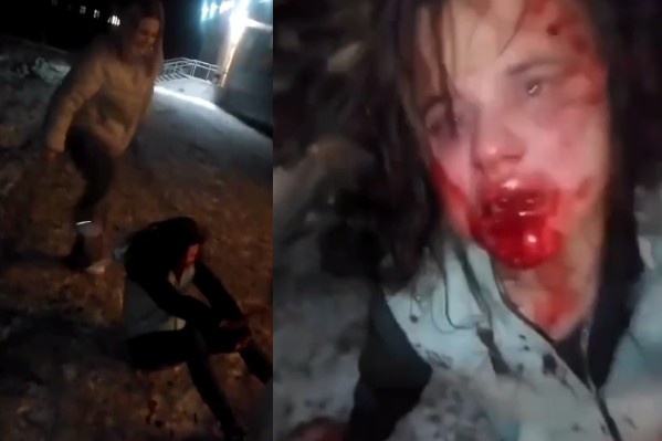 Cruel Teen Girls Kick 27YO Woman In The Face After A Dispute