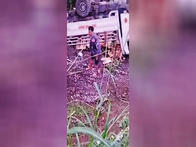 HIS LEG IS RIPPED APART TO THE BONE