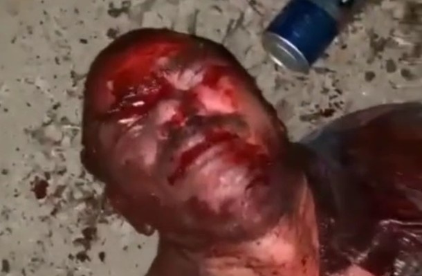 Man Murdered With Machete After Savage Beating By Narcos