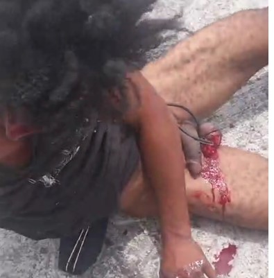 Rapist Has his Balls Cut off in Vila Velha, Brazil
