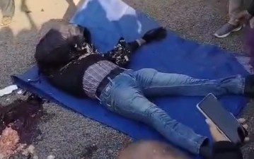 HE LOST HIS BRAINS IN AN ACCIDENT