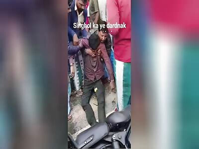 HE HAS MULTIPLE FRACTURES THROUGHOUT HIS BODY