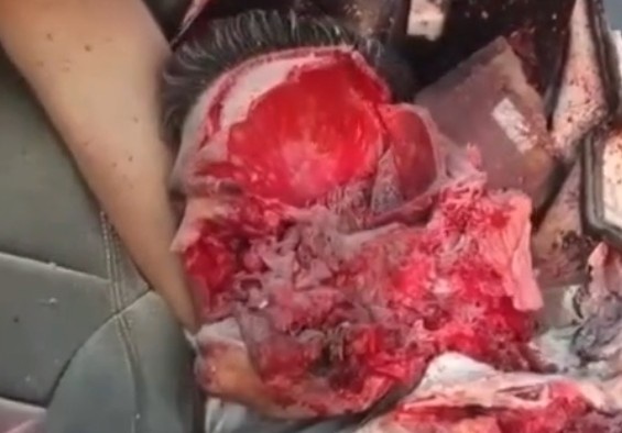 HIS HEAD WAS BLOWN APART  