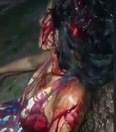 Woman brutally assaulted by her husband