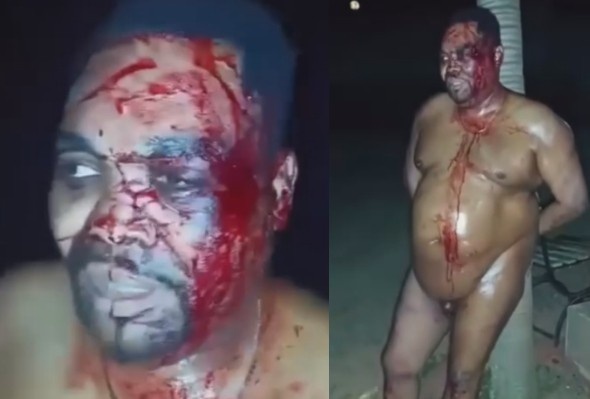 Local Politician Beaten And Stripped Naked By Vigilantes In Kenya