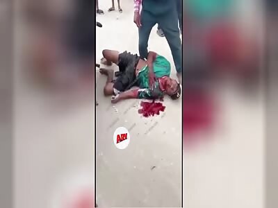 MAN DYING AFTER BEING SHOT