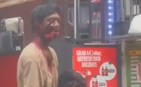 HE GET THE FACE CHOP WAY AND THE FINGERS TOO