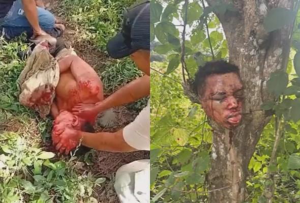 Man Accused Of Killing A 3-Year-Old Girl Beheaded In Colombia