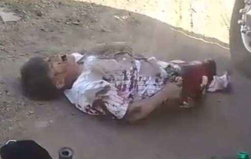 Man loses leg in moto accident