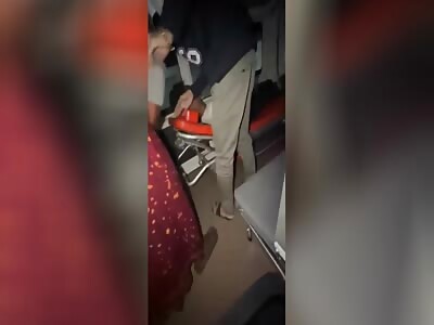 Anybody need an arm?