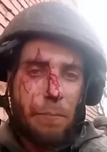 First injured and then allegedly eliminated