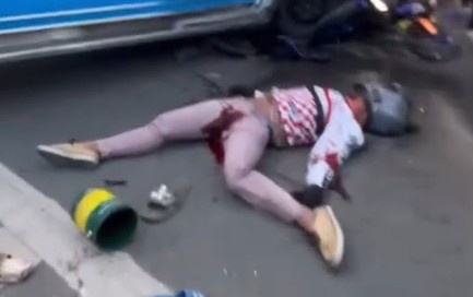 Vaj bleeds out after horrible accident