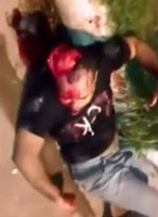 Wtf guy has half his head scalped in motor bike accident 