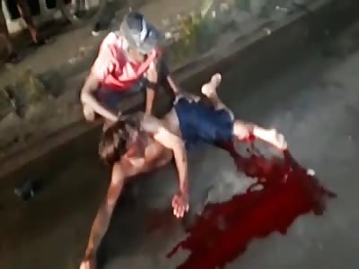 Mangled Leg After Getting Hit By Car {Aftermath}