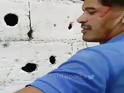 Baseball Bat To The Spine Then Beaten