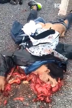 Accident Turns A Man Into Road Pizza