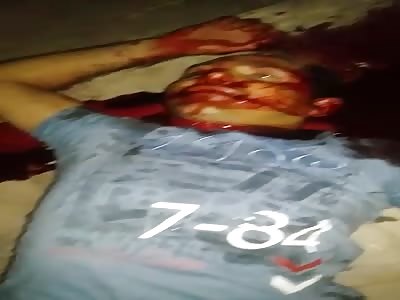 Onlookers Record A Dead Man As His Blood Oozes Out