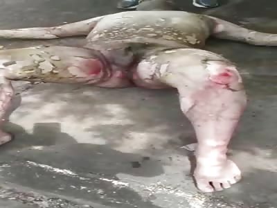 Man Tried Killing Himself By Setting Himself On Fire 