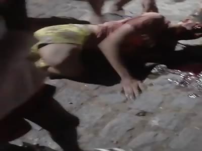 Man All Sorts Of Fucked Up Awaits Medical Help